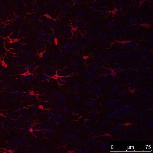 mikroglia